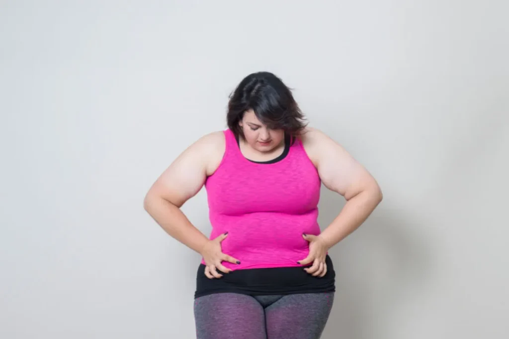 A woman facing obesity.